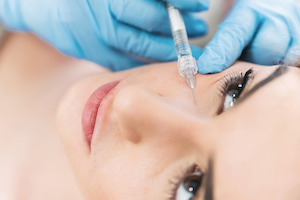 facial fillers