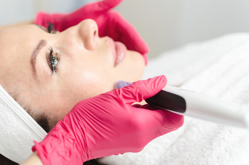 microneedling with PRP