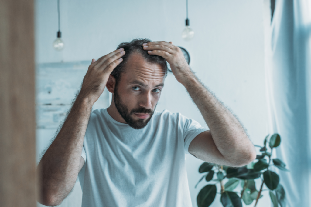 Microneedling can help reduce hair loss.
