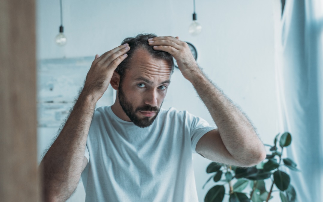 Hair Loss and Microneedling